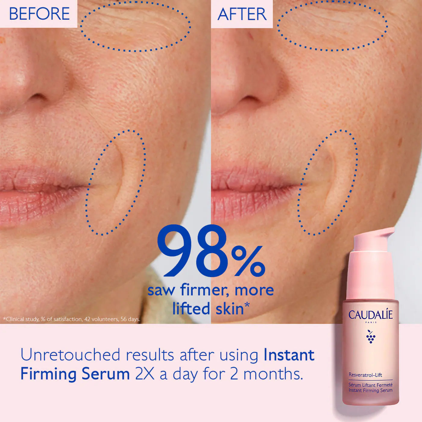 Caudalie Face Lift Serum